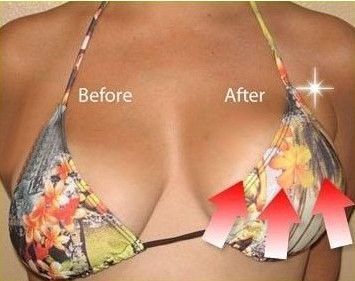 Невидимий бюстгальтер наклейки для підняття грудей BARE LIFTS, Бюстгальтер невидимка 3375279 фото